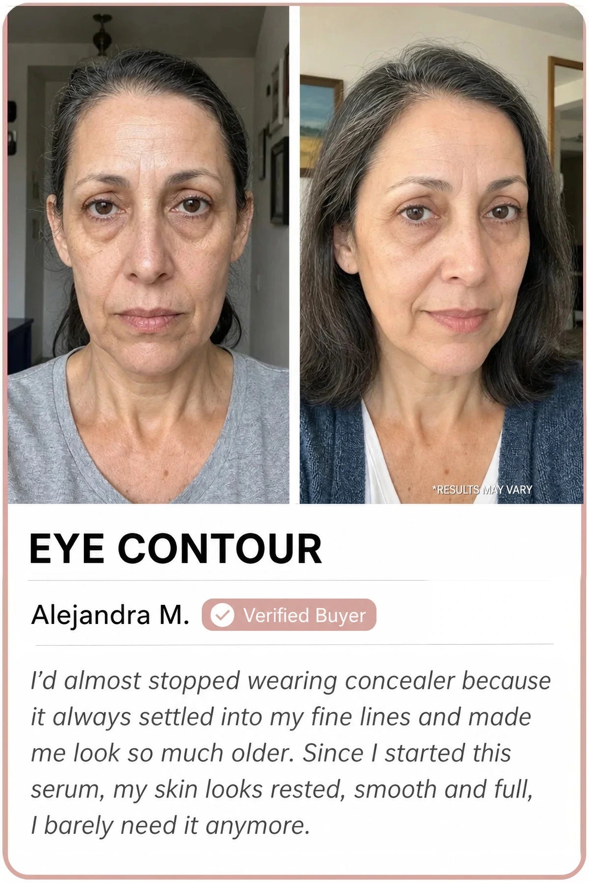 Sedanza before and after — Eye contour, Alejandra M.