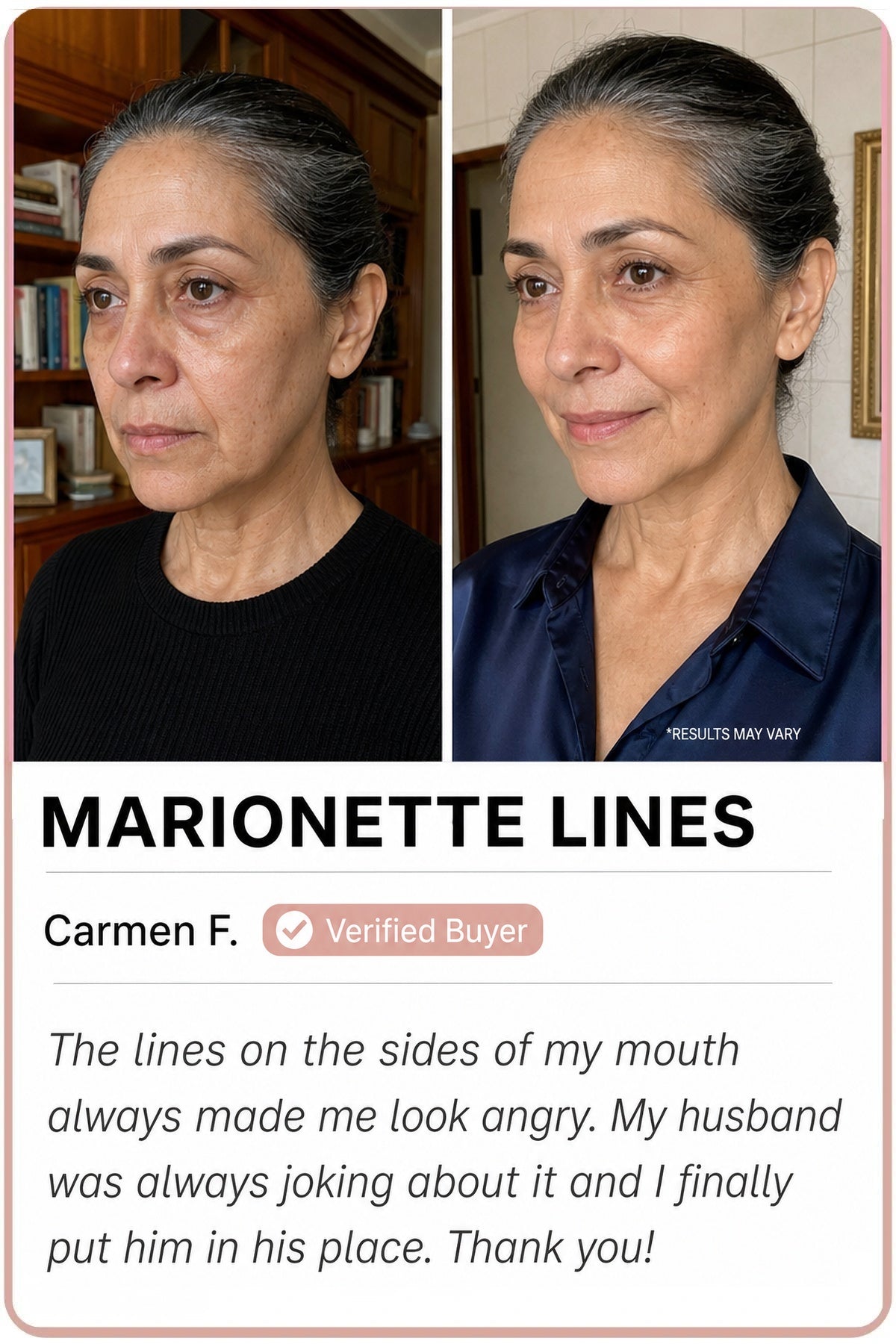 SEDANZA customer transformation