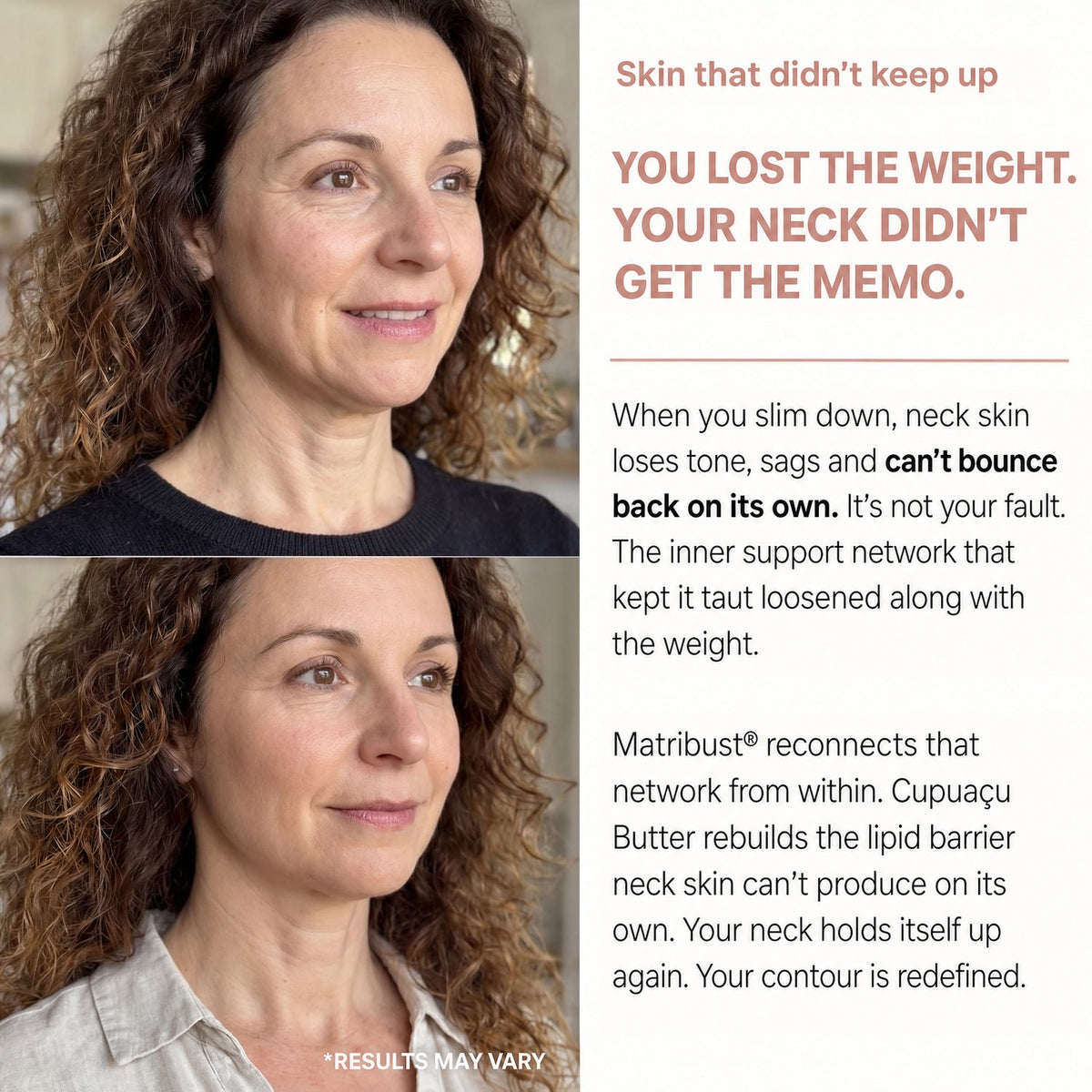 You lost weight, your neck didn't get the memo